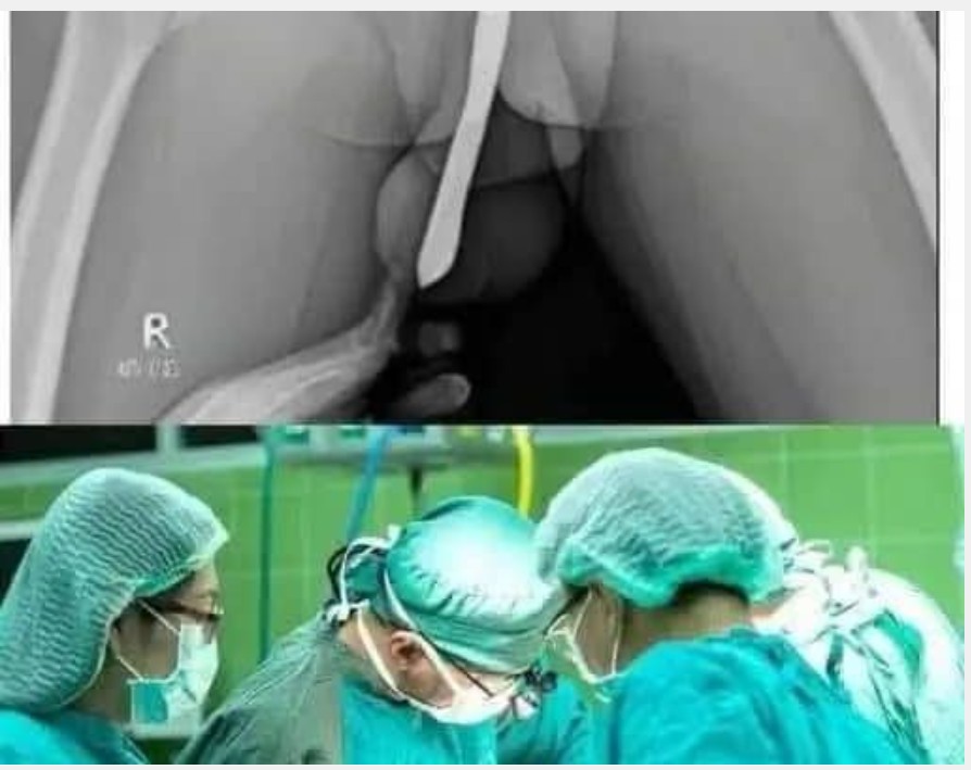 Doctors are speechless: Just boil these 2 ingredients and you will quickly lose your body fat !!